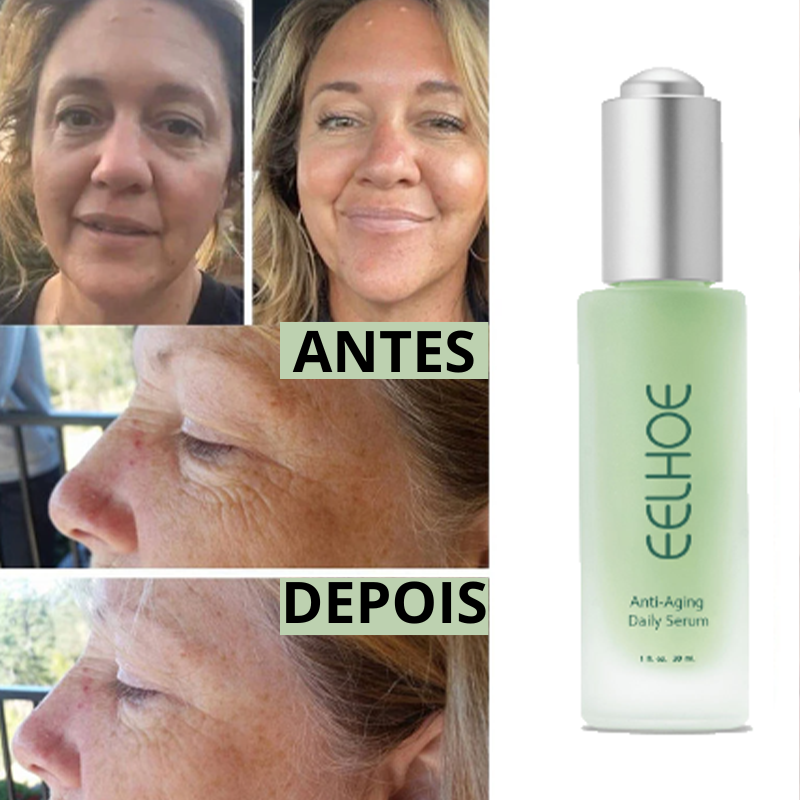 Óleo facial One Eelhoe aloe vera anti-envelhecimento - Remove rugas e manchas