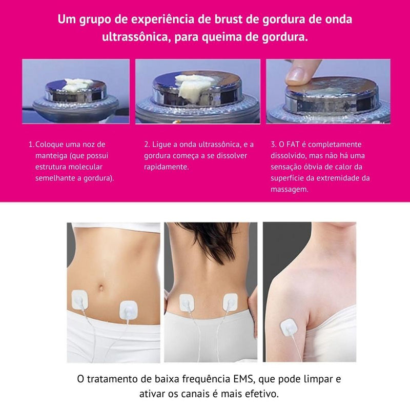 Lipocavitação Ultrassônica Para Redução De Gordura E Celulite